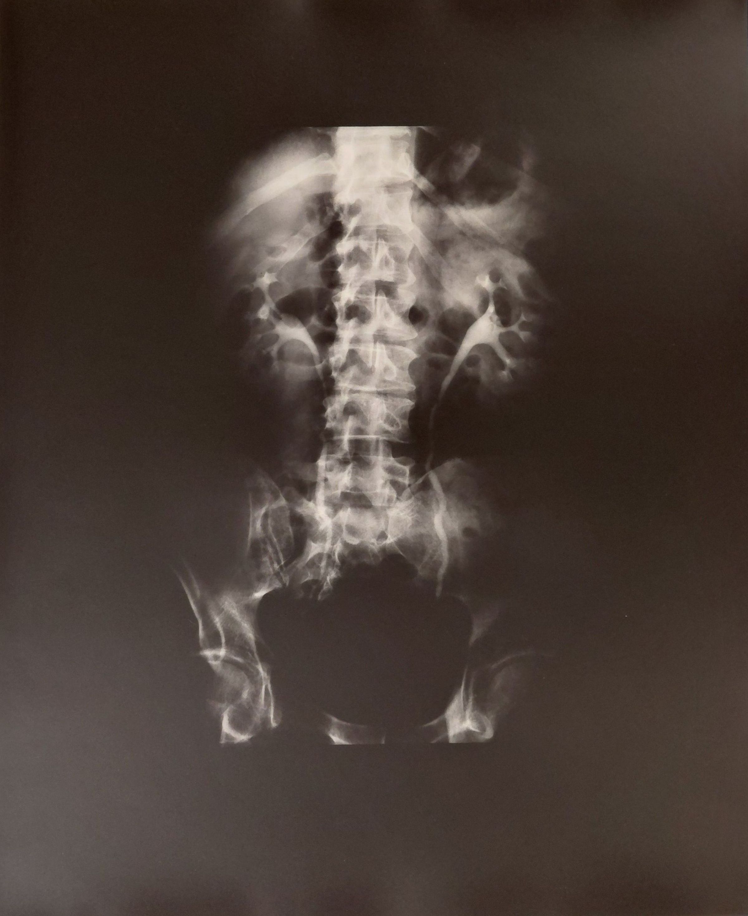 Light Memory #21 (Spine)