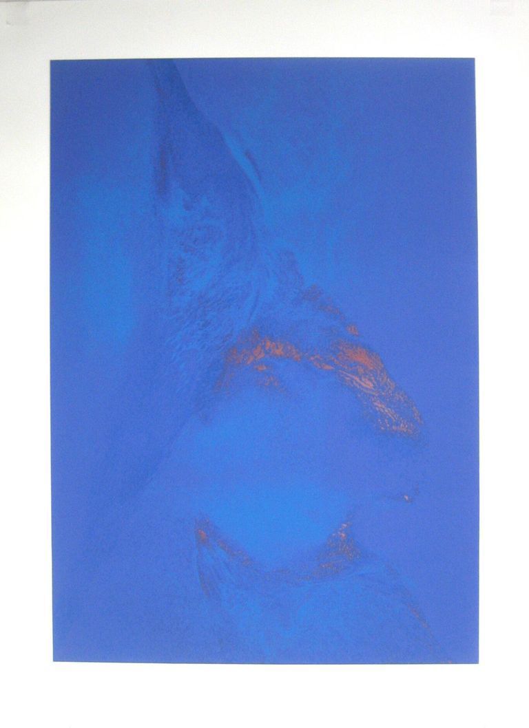          This Blasted Health picture number 1
   