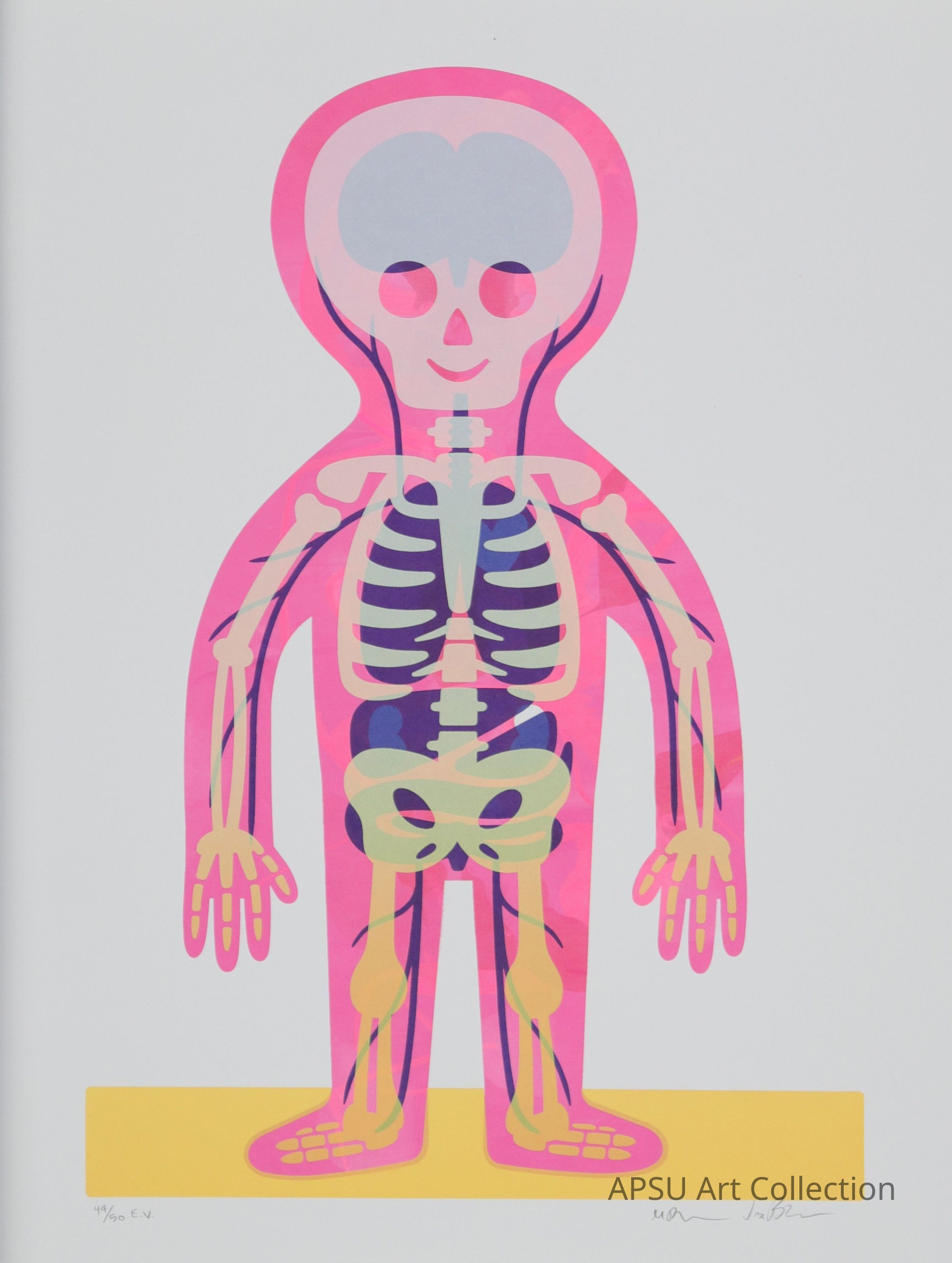 This image features a colorful, stylized artwork of a human skeleton with a pink overlay that has a face, presenting a playful and modern interpretation of anatomical illustrations. The skeleton is detailed, yet artistic, with bright pink, yellow, and blue hues setting a vivid contrast against a light background, and it appears signed and numbered by the artist, indicating it’s part of a limited series.