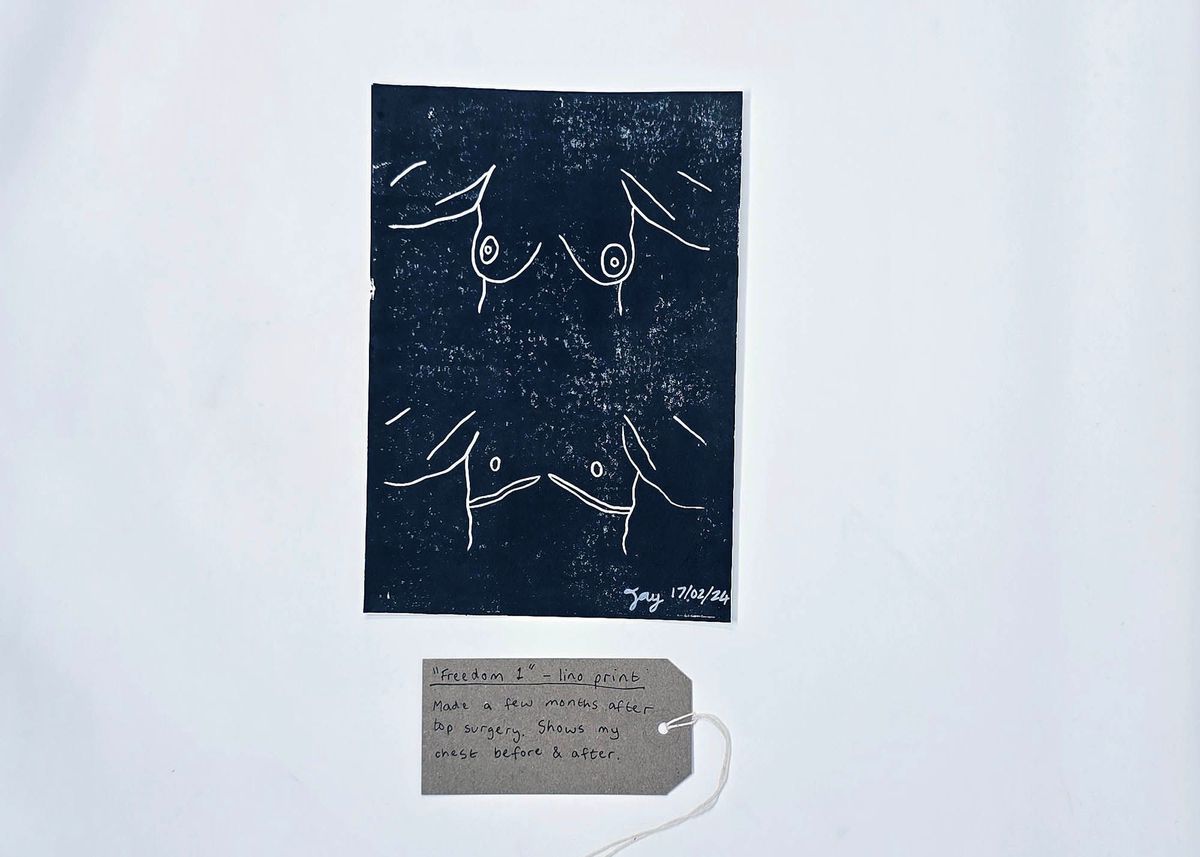 A handmade lino print block with line drawings of  two torsos; one before, one after, top surgery; signed Jay 17/02/24. With a brown, handwritten luggage tag.