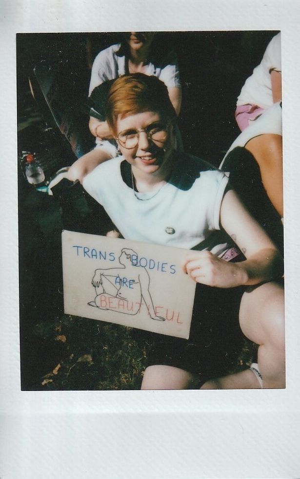 A person with glasses holds a sign saying "Trans Bodies Are Beautiful" while sitting on the grass outdoors.