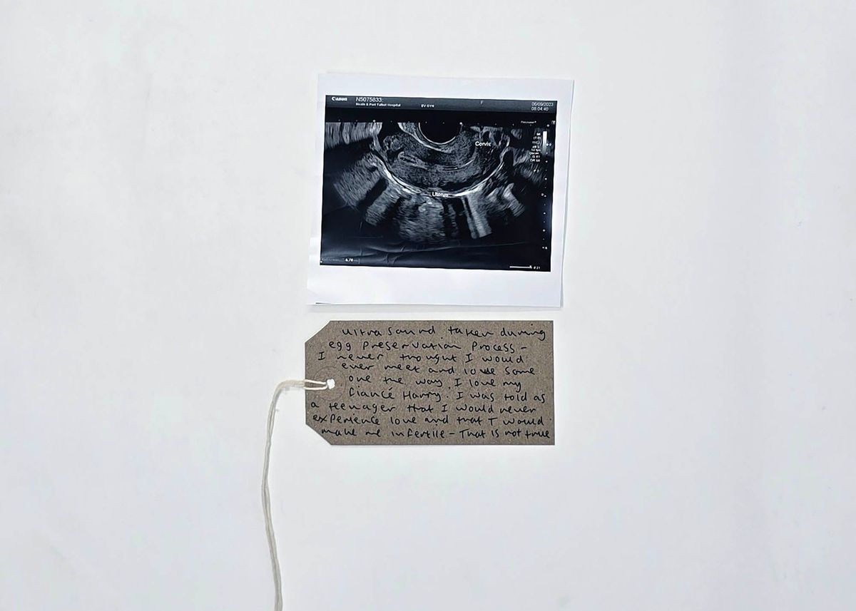 A black and white photo of a ultrasound scan. With a brown handwritten luggage tag.