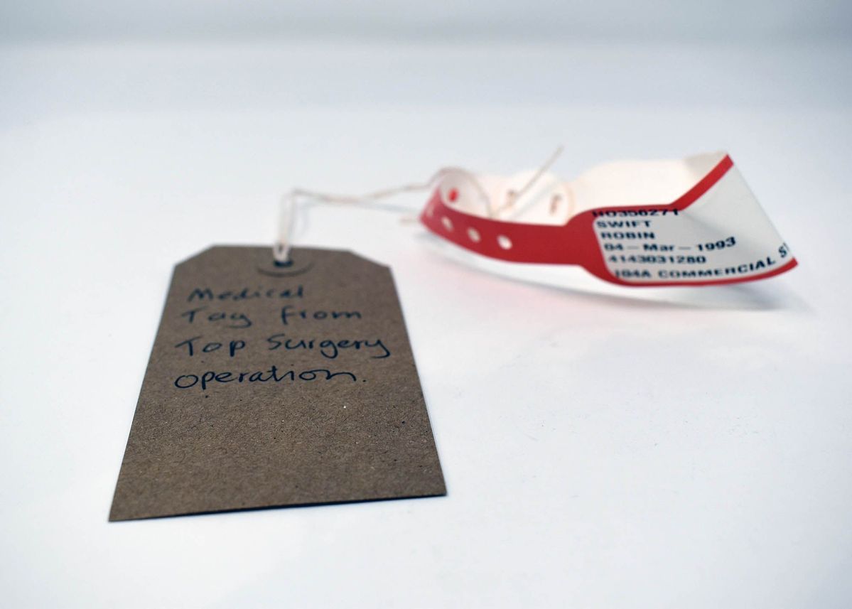A medical tag labeled "Top Surgery Operation" rests beside a white and red hospital bracelet.